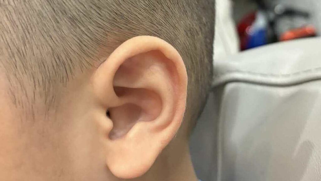 Điều gì xảy ra khi vệ sinh tai thường xuyên?